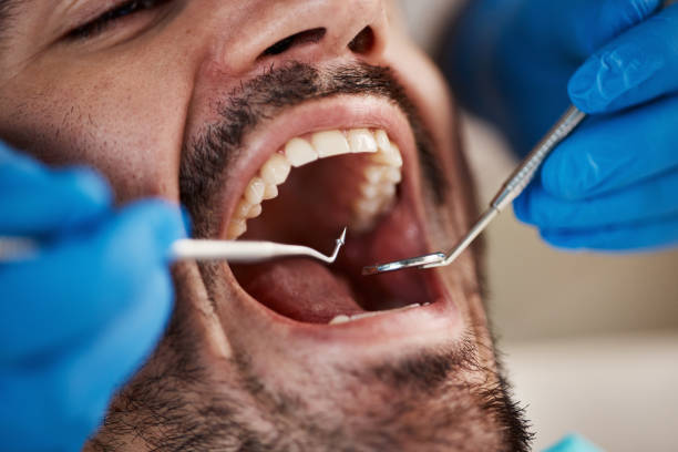 Best Orthodontic Emergency Dentist in Forsyth, GA